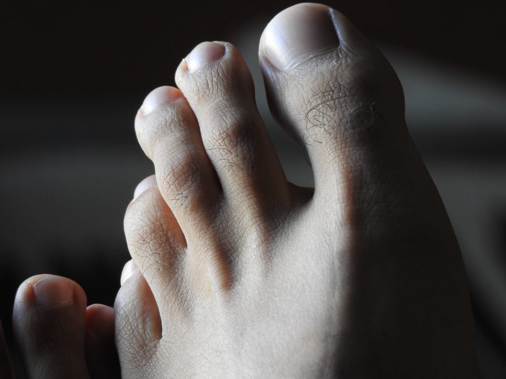 Diabetic foot care, discipline is require to stay healthy